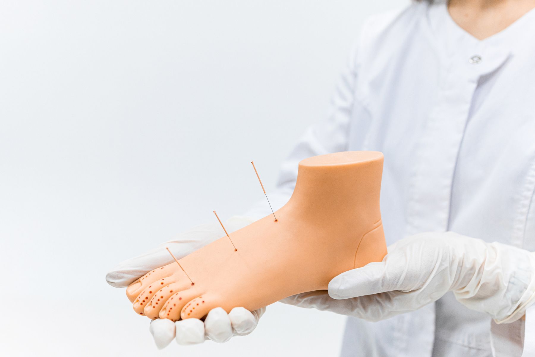 Séance d'acupuncture sur le pied pour soulager la douleur